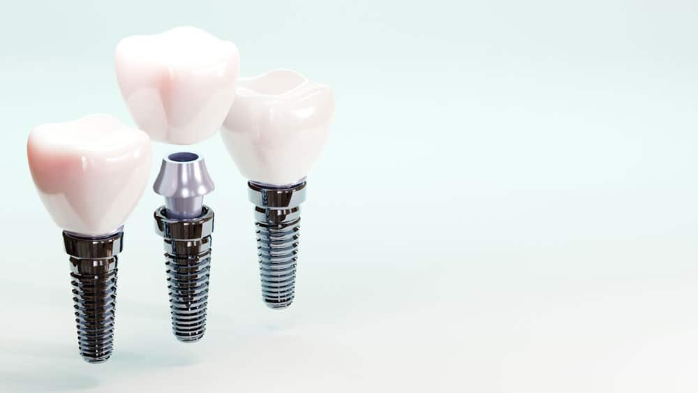 Porcelain crowns Cambridge