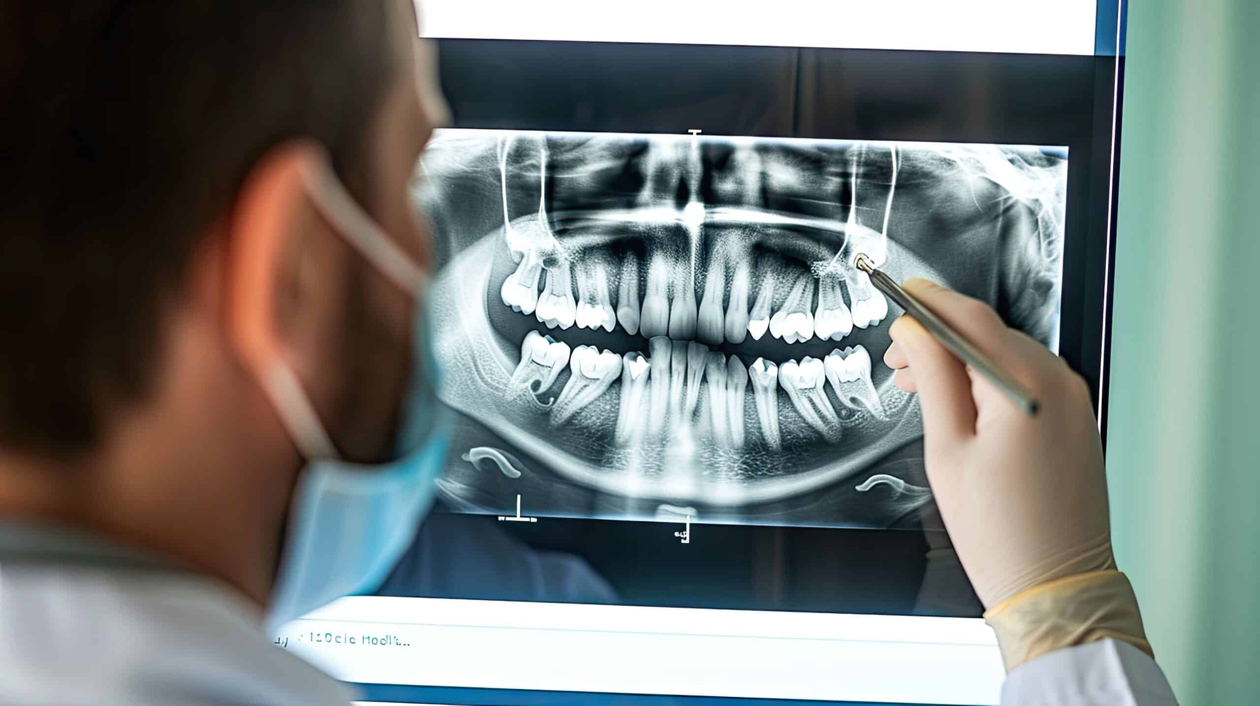 Dental root canal Cambridge