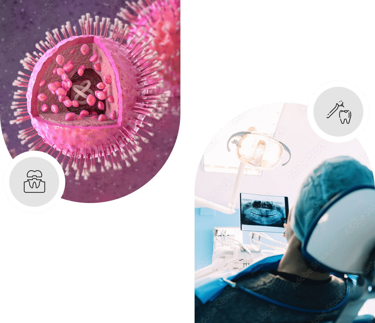 Oral health screening Cambridge