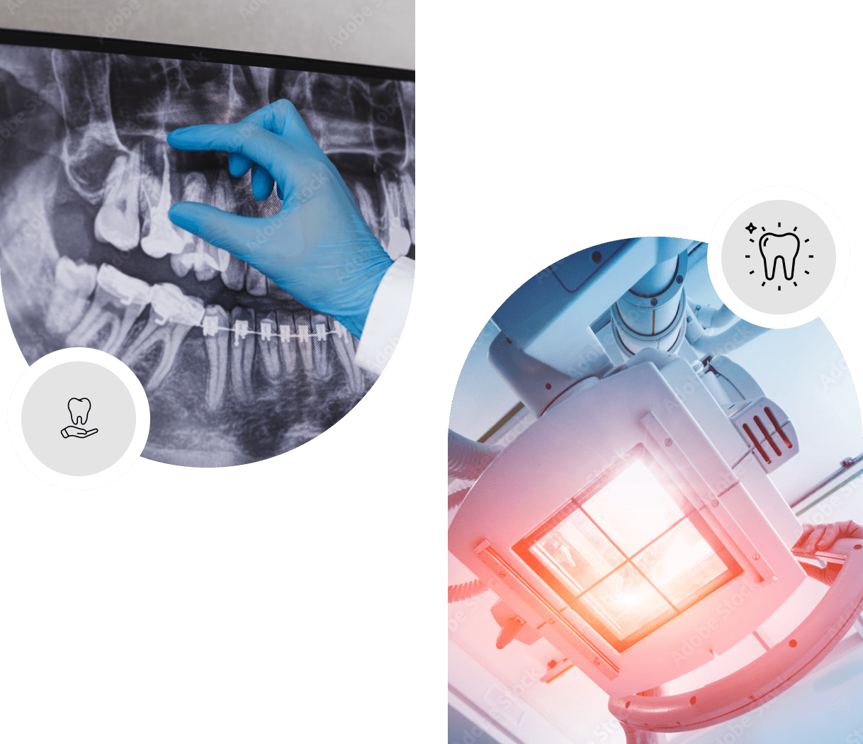 Modern dental X-ray system