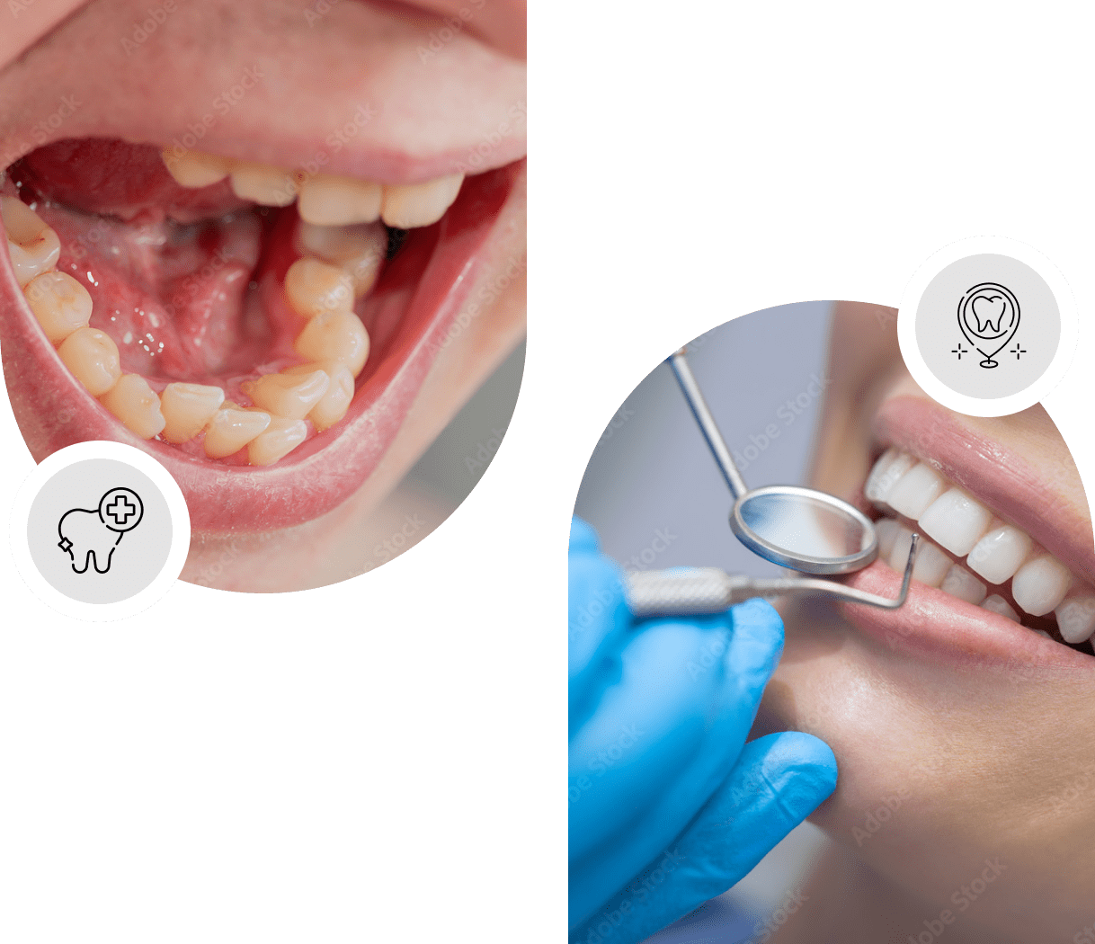 Dry mouth treatment Cambridge