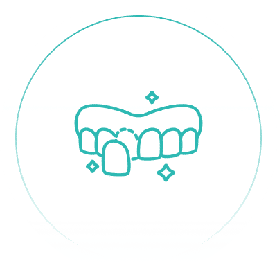 Cosmetic dentist veneers Cambridge