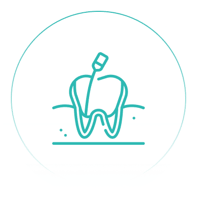 Root Canal Treatment in Cambridge, ON