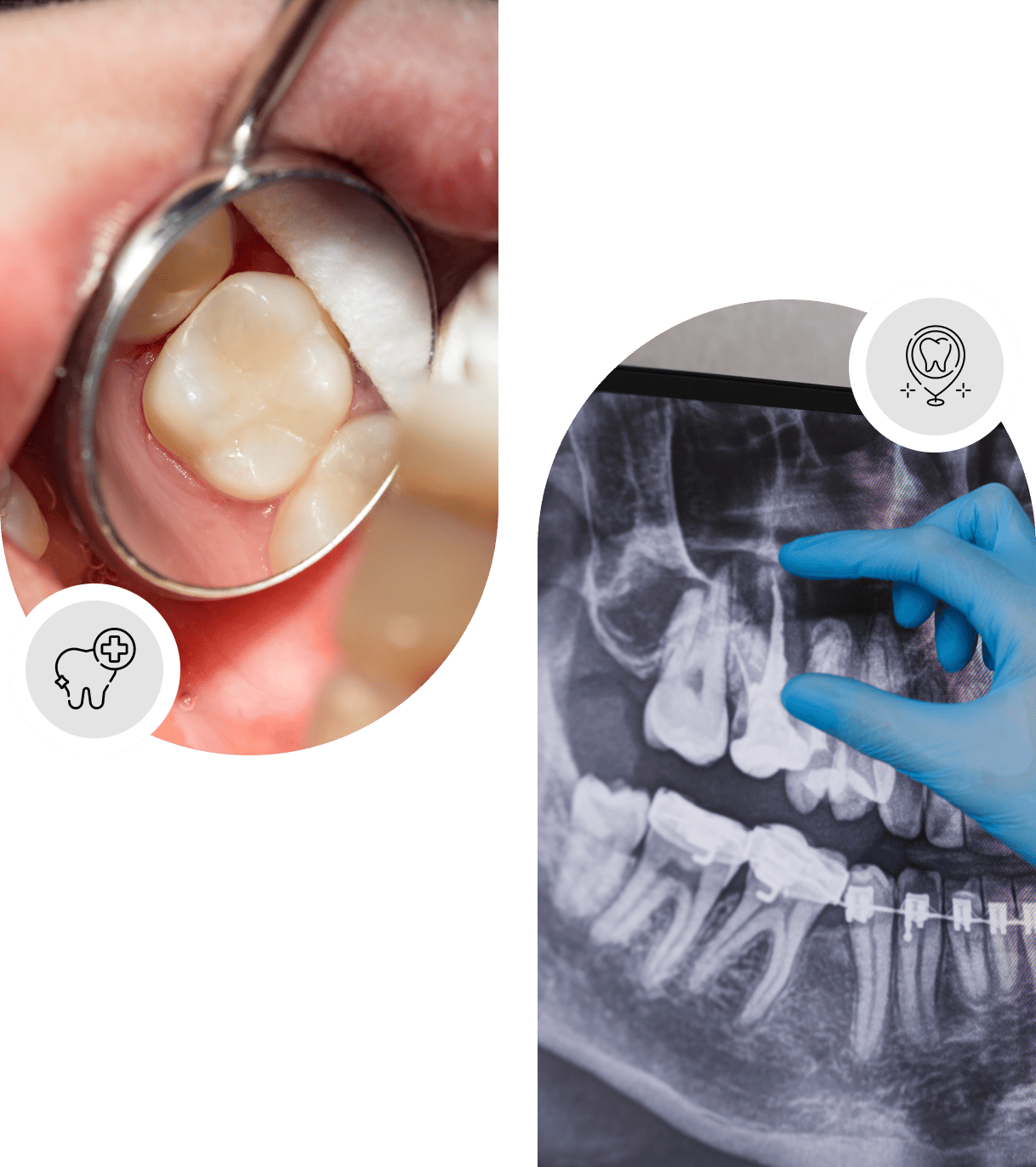 Tooth fillings Cambridge Ontario