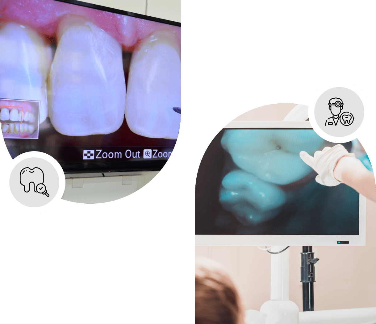 Tooth camera for dental exams