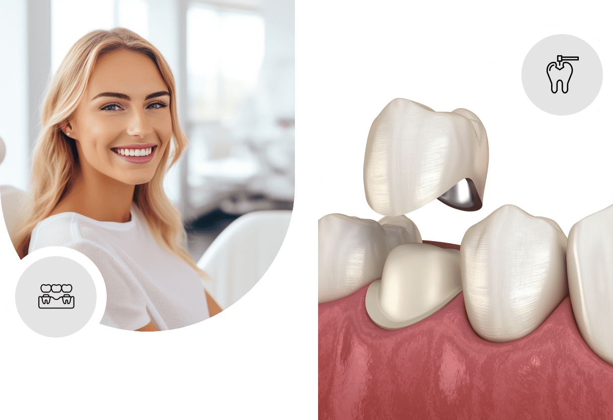 Dental crowns Cambridge