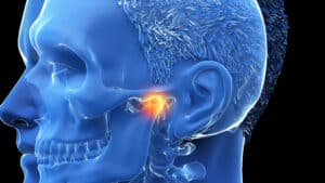 Do the symptoms of TMJ go away